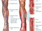 Deep Vein Thrombosis (DVT)