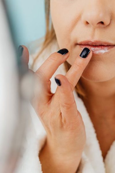 Pucker Up! How to Heal Cracked Lip Corners Fast