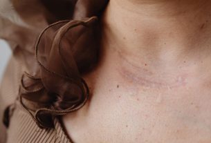 A Small Lump in Her Neck Led to 2 Rare Tumors and a 24-Hour Surgery