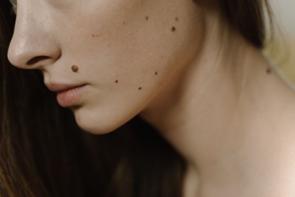 6 Signs Your Skin Needs Medical Attention, Stat