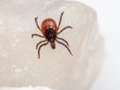 Doctors suspected man had brain cancer. He actually had worms.