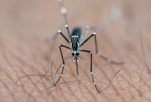 Bye-Bye Bites: 14 Ways to Get Rid of Mosquito Bites Overnight