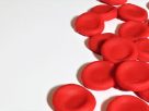 Louisiana Man Becomes First In Region to Be Functionally Cured of Sickle Cell Disease