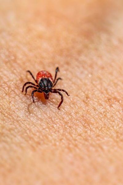 ER Visits for Tick Bites Highest in Over a Decade. How to Protect Yourself